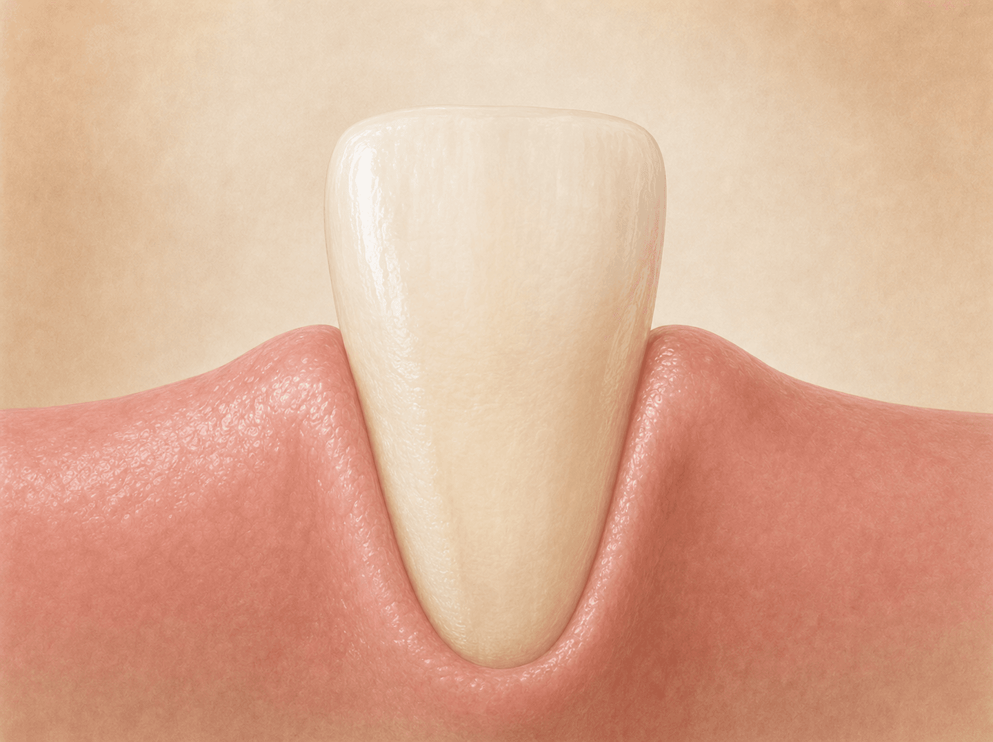 Editorial illustration of a single tooth and the surrounding gumline seen in a flat, straight-on clinical close-up view (2D intraoral photographic image), warm muted tones
