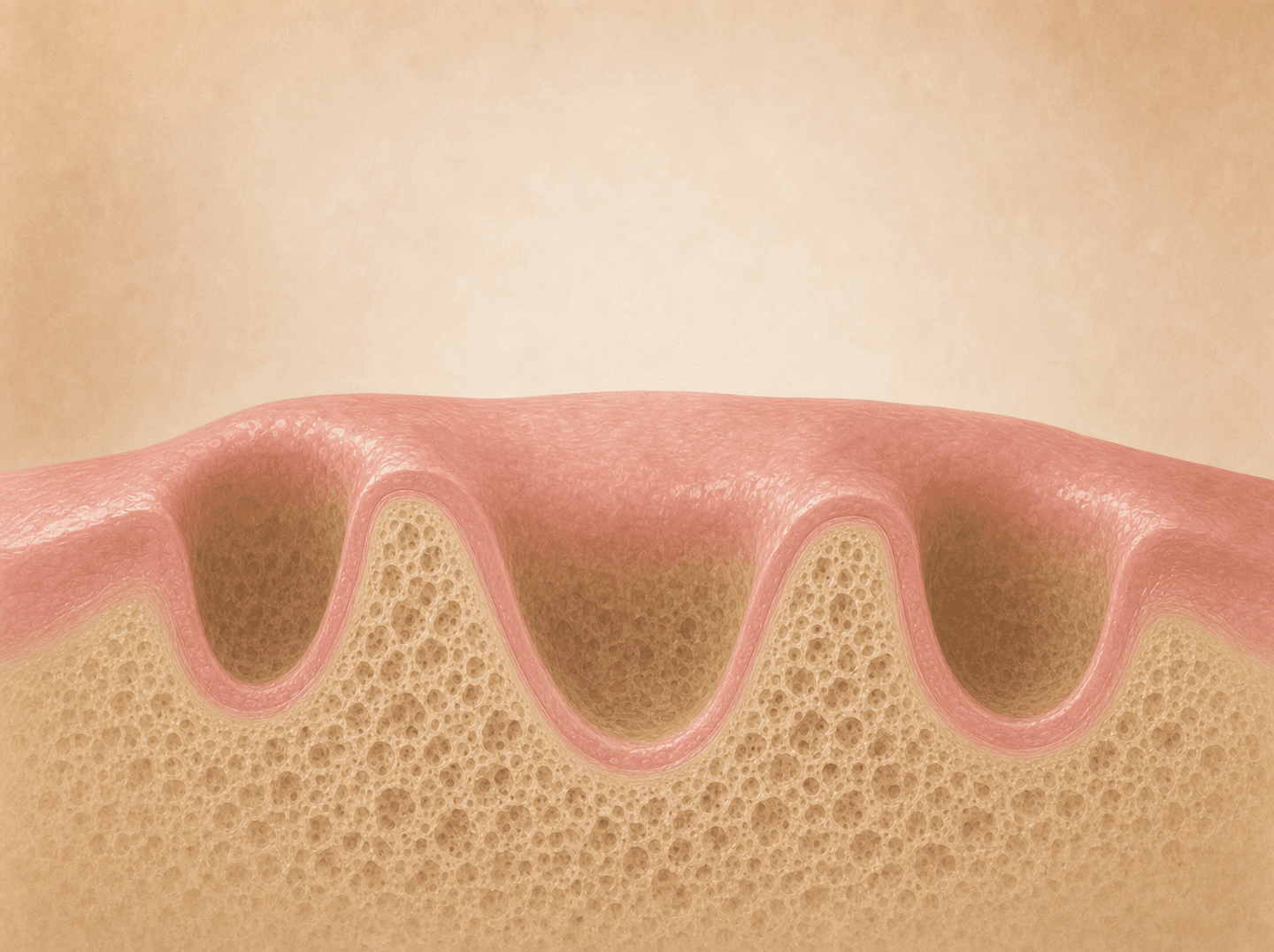 Editorial illustration of a dental ridge being smoothed after one to three extractions in a single quadrant (alveoloplasty), warm muted tones